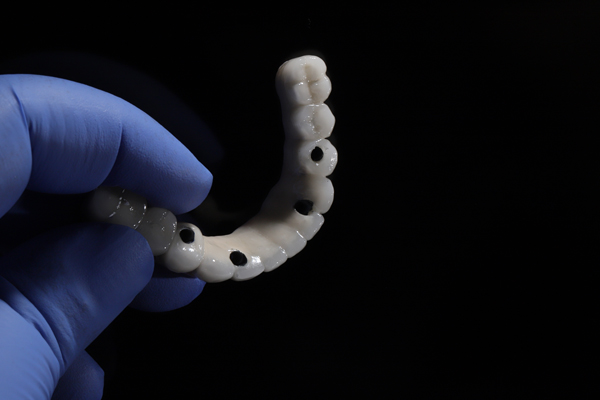 all on 4 implants 2603 5 Facts You Need to Know About All-on-4 Implants