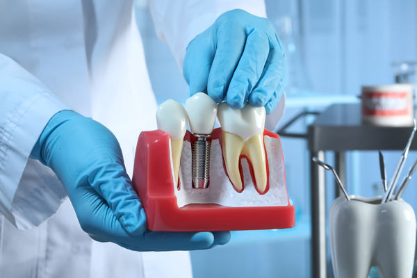 dental implant 2503 Services Page Template
