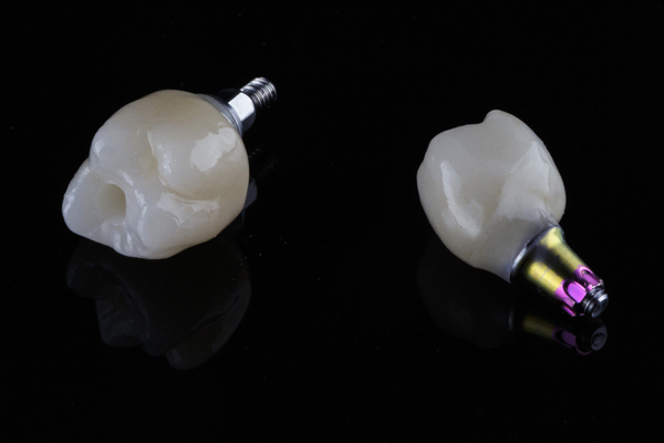 dental implants 2505 Services Page Template